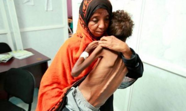 16 Milyondan fazla Yemenli açlık çekiyor