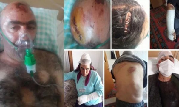 15 barodan ırkçı saldırılara kınama: Telafisi olmayan olaylar