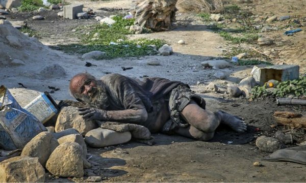 67 yıldır duş almayan adam doktorları şaşırttı