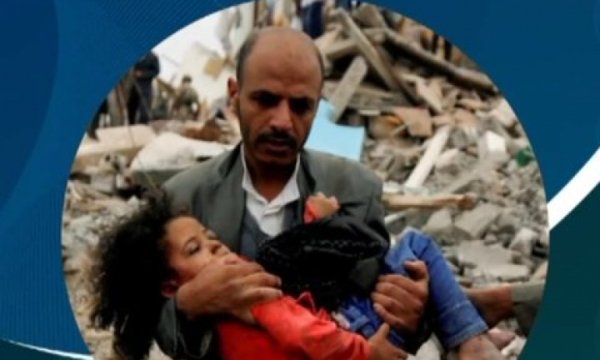 Yemen halkına destek için İstanbul Saraçhane parkında buluşuyoruz (Davet)