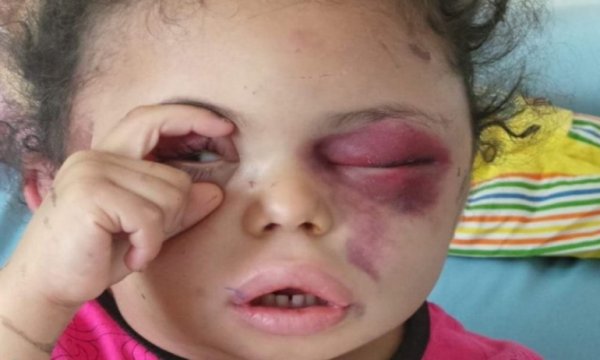 Yemen’in Ukrayna’dan farkı ne?