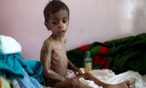 BM: Yemen'de milyonlarca insan yeterince yiyecek bulamıyor