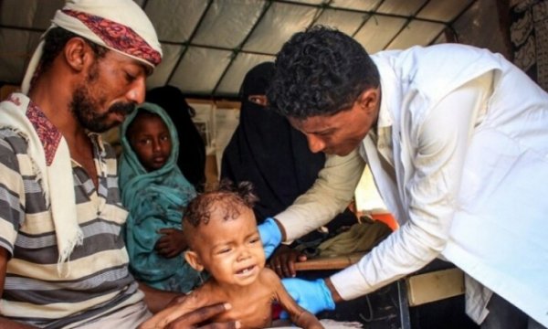 Açlık Yemen'de can almaya devam ediyor
