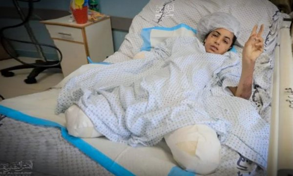 Filistinli çocuk İsrail saldırısında bacaklarını ve kolunu kaybetti