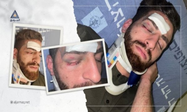 Kudüslü şoföre Lud Havaalanı'nda ırkçı saldırı