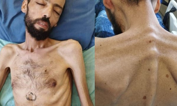  Açlık grevindeki Filistinli "idari tutuklu" Avavde derhal serbest bırakılmalı