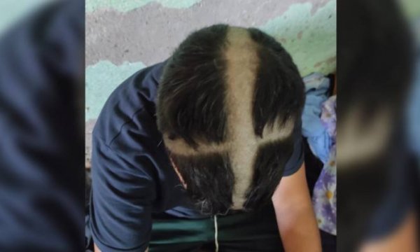 Macar polisi Faslı mültecinin kafasına haç kazıdı