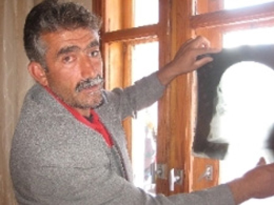 20 Yıldır Kafasındaki Kurşunla Yaşıyor