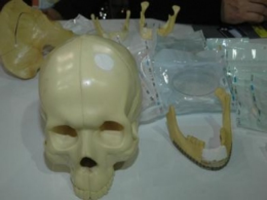 Selçuk Üniversitesi Yumurtadan Kemik Dolgusu Üretti
