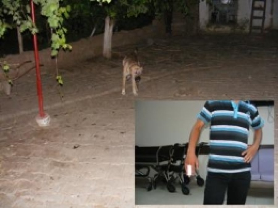 Sokak Köpeği Köylüyü Isırdı