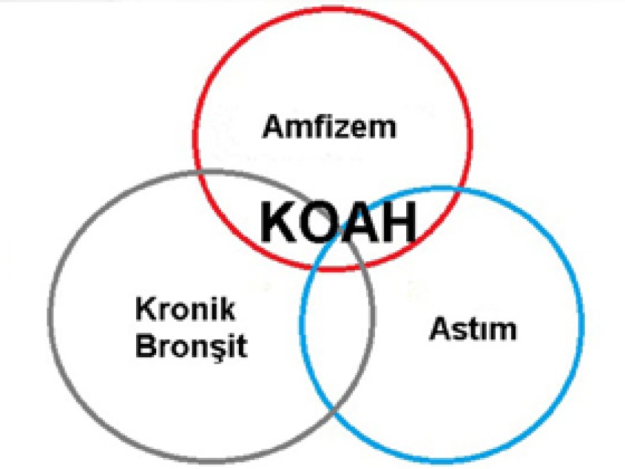 KOAH Ülkemizde Üçüncü Ölüm Nedeni