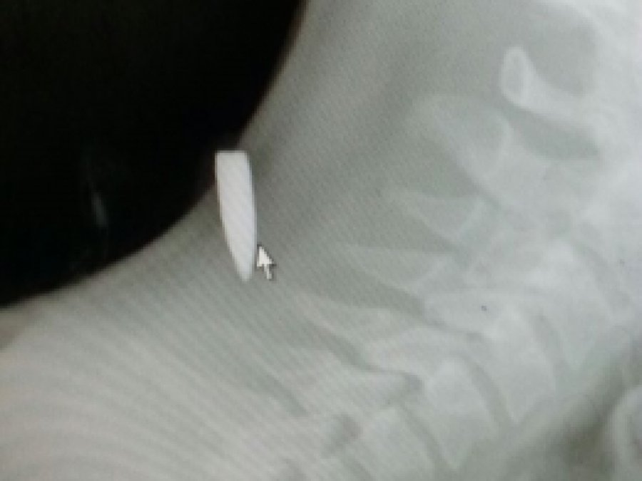 Maç izlerken keleş mermisiyle yaralandı