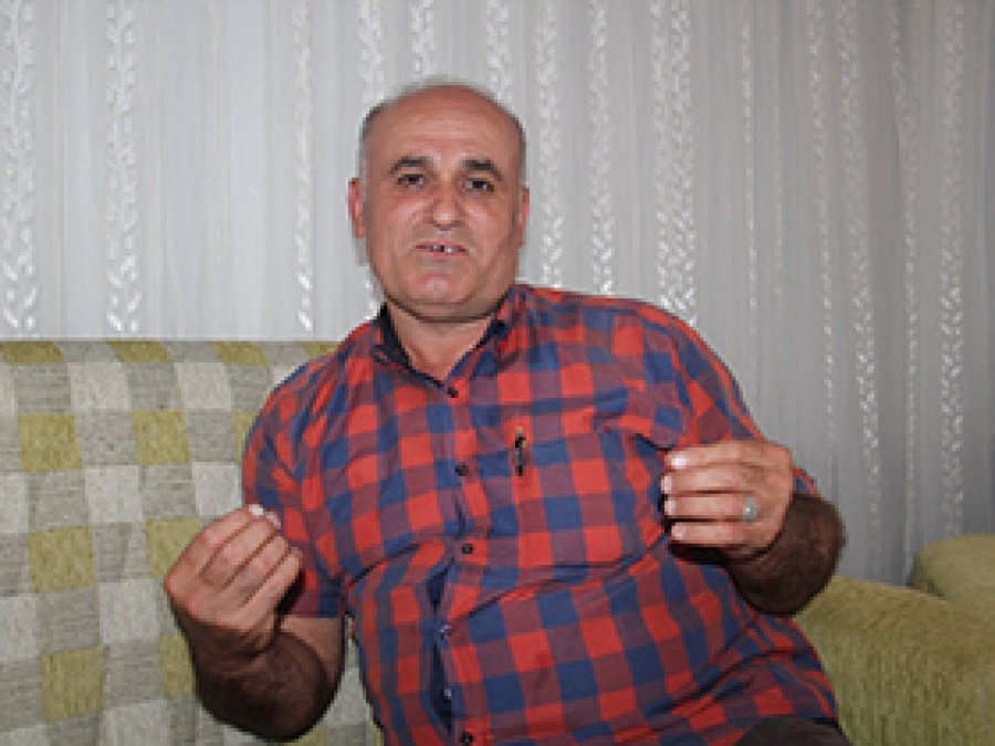 Fil hastası genç kız yardım bekliyor