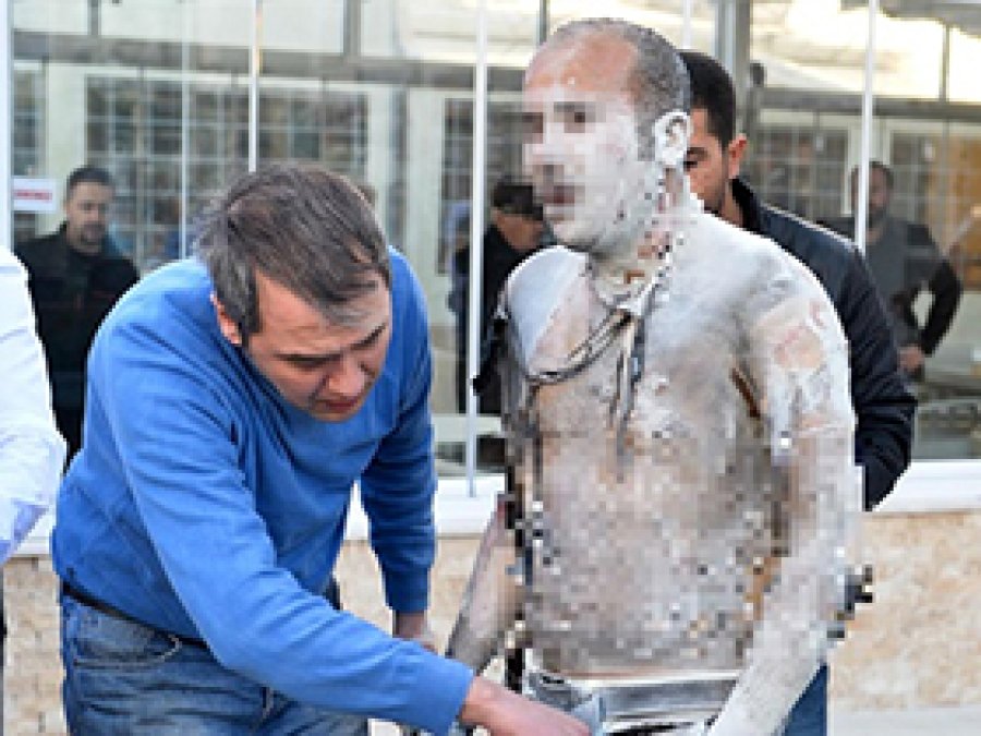 Antalya'da kendini yakan adam öldü