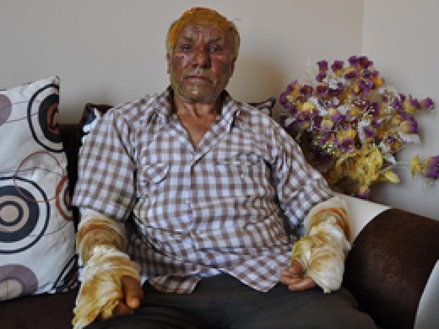 PKK'nın insanlıkla alakası yok