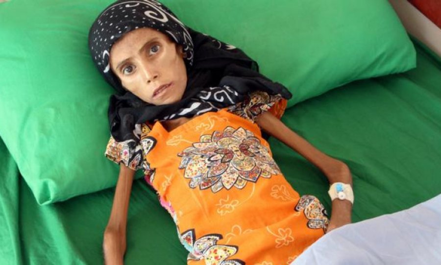 UNICEF: Yemen'de 12 milyondan fazla çocuk insani yardıma ihtiyaç duyuyor