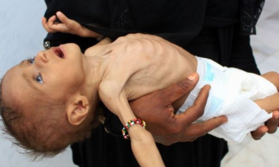 BM Genel Sekreterinden Yemen'e acil yardım çağrısı