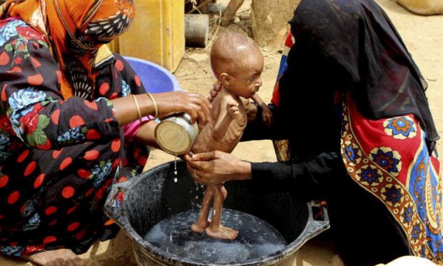 Amerika siyasetleri sonucu Yemen’de yaşanan insani facianın boyutları