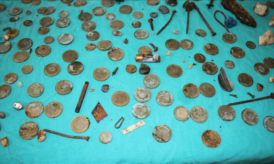 Midesinden 233 parça yabancı cisim çıkarılan hasta sağlığına kavuştu