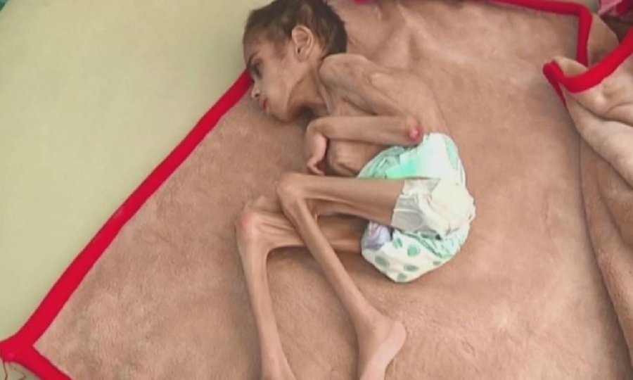 BM: 19 Milyon Yemenli açlıkla mücadele ediyor
