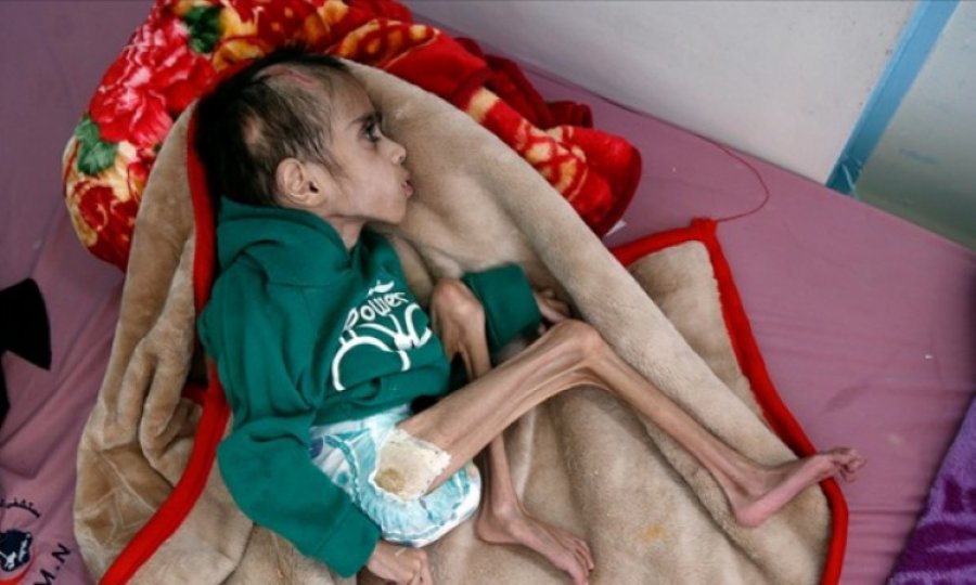 172 İnsan hakları kuruluşundan Yemen'deki insani felaketin durdurulması çağrısı